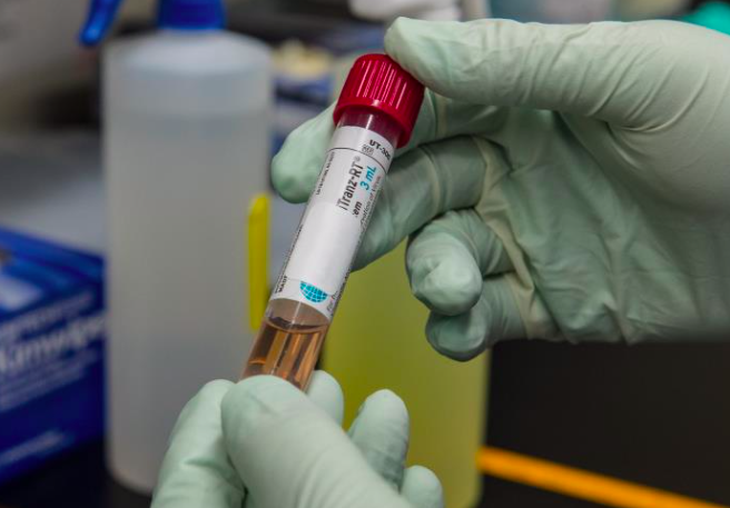 A test tube with viral transport media that contained a patient’s sample to be tested for the presence of SARS-CoV-2, the virus that causes COVID-19. (provided by the CDC)
